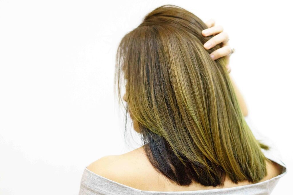 test genetico alopecia